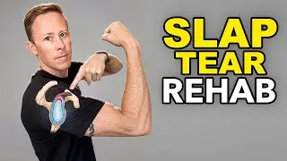 How to Rehab a SLAP Tear Without Surgery (Shoulder Labrum Injury)