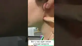 СЕКРЕТЫ КИТАЙСКОЙ МЕДИЦИНЫ. КАНАЛ ТРОЙНОГО ОБОГРЕВАТЕЛЯ. ТОЧКА TR17 -  И-ФЭН.