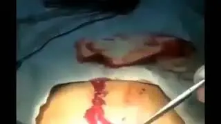 Операция