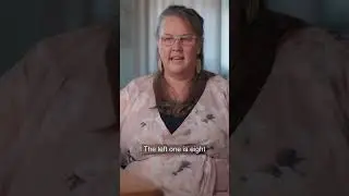 Jennie speaks about how her Bilateral Talipes Equinovarus (clubfoot) has affected her in her life.