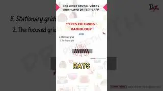 Types of Grids in Radiology