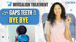 All About Invisalign Treatment | Invisalign Braces Cost & Treatment Process