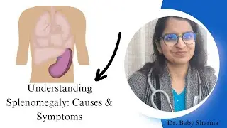 Understanding Splenomegaly: Causes and Symptoms Explained