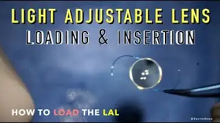 HOW TO LOAD the Light Adjustable Lens | LAL Loading & Insertion