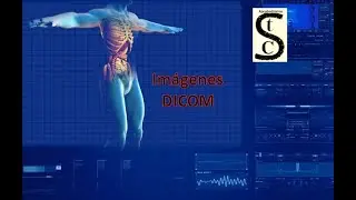 🩻​⚕️Imágenes DICOM 🩺​🚑​  Características y visualización