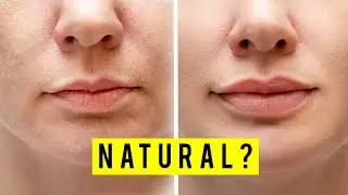 Plastic Surgeon Answers Your Lip Questions