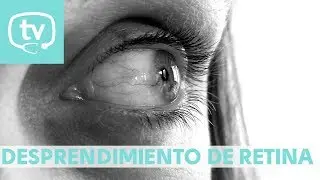 Desprendimiento de retina, ¿en qué consiste?