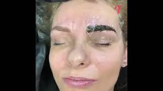 New eyebrows wiped a decade off her face
