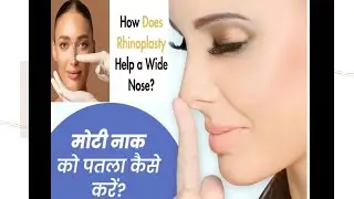 मोटी चौड़ी नाक की सर्जरी का खर्चा I COST TO NARROW THE BROAD NOSE I NOSE JOB RHINOPLASTY IN DEHRADUN