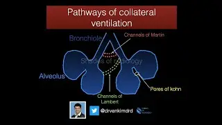 Collateral ventilation in Lungs - Simplified