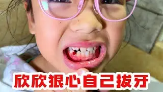 老苗真狠心，自己给欣欣拔牙，太狠了