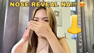 NOSE REVEAL! (12 DAYS AFTER OPERATION) | Martinavlogs