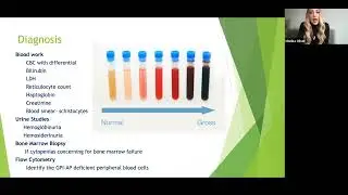 Emerging Treatment Options in PNH