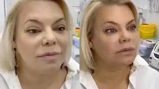 Яна Поплавская делает уколы красоты