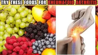 Best Foods For Rheumatoid Arthritis
