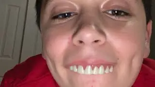 Hilarious fake horse teeth review!