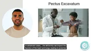 Pectus Excavatum