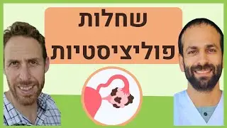 שחלות פוליציסטיות - טיפול טבעי