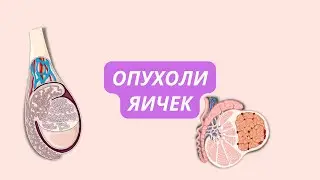 Опухоли яичек 🥜 разновидности, как распознать и как отличить?