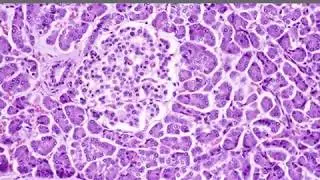 Biochemical Basis of Diabetes Mellitus