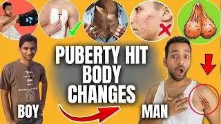 PUBERTY BODY CHANGES IN MEN | Guy Problems (NightFall, Acne) | TEEN LIFE SAVING HACKS | ANKIT TV