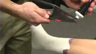 Снятие повязки с голеностопного сустава