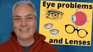Eye issues and Corrective Lenses - Myopia - Hypermetropia - Astigmatism - Bifocal Contact lenses