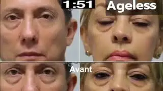 รีวิว ครีมทาถุงใต้ตา Jeunesse Instantly Ageless Id Line:@568hlhin