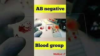 abo blood group | ab negative blood group #shorts #dayinthelife #doctorsvlog #viral #vlog #trending