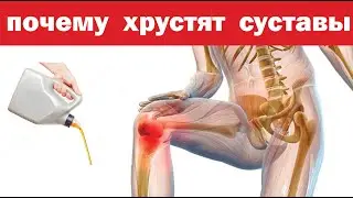 О каких проблемах говорит хруст в суставах. Опасный сигнал