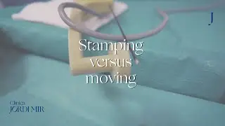 Stamping versus moving