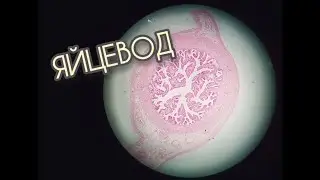 OVARICANT (fallopian tube)