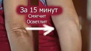 Dry rough skin on elbows. Dark rough elbows what to do. 15 min. Lightening and softening.