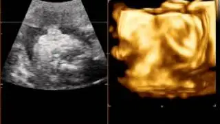 baby video 1 (baby's labia)