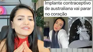 Implante Anticoncepcional de australiana vai parar no coração!