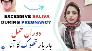 Excessive Saliva During Pregnancy | دوران حمل بار بار تھوک کا آنا | Dr Khalood Imran