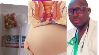 conseils santé le docteur explique la gravité de le maladie des hémorroïdes