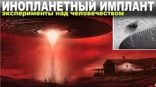 ИНОПЛАНЕТНЫЙ ИМПЛАНТ (эксперименты над человечеством). Рогожкин В.Ю.