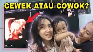LUCU BANGET ADIK ANYA MEGANGIN KEPALA!