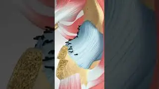 Open Surgery to Correct Hip Impingement (Irregularly Shaped Femoral Head) 