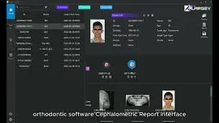 Automatically generate orthodontic analysis report