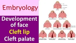 Embryology of face & different types of Cleft lip and palate @ZeroToFinals
