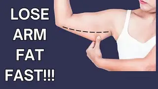 ARM TREATMENT | Lose ARM FAT FAST | Tone and Tighten your Arms