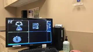 Check Out a CT of my Sinuses