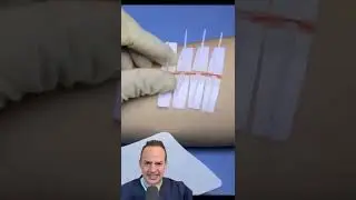 AMAZING WAY TO FIX A CUT WITHOUT STITCHES!😱 