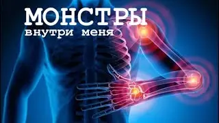 Монстры внутри меня