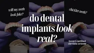 Do Dental Implants Look Fake? | MUST-KNOW tips for a Beautiful, Natural Smile