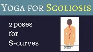 2 yoga poses adapted for s-curve scoliosis