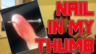 I SHOT A NAIL INTO MY THUMB!