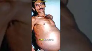 Ketika Pria Hamil